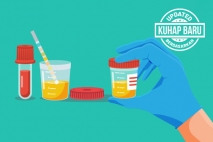 Bisakah Merehabilitasi Pecandu Narkotika Hanya Berdasarkan Hasil Tes Urine?
